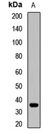 CRHBP Rabbit Polyclonal Antibody
