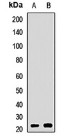 CSRP3 Rabbit Polyclonal Antibody