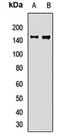GRP170 Rabbit Polyclonal Antibody