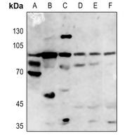 ACSL4 Rabbit Polyclonal Antibody