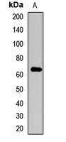 Collagen 10 alpha 1 Rabbit Polyclonal Antibody