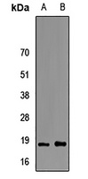 FABP6 Rabbit Polyclonal Antibody