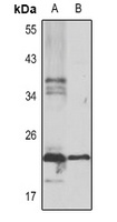 Serglycin Rabbit Polyclonal Antibody