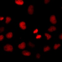 HIRIP3 Rabbit Polyclonal Antibody