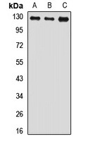 USP8 Rabbit Polyclonal Antibody