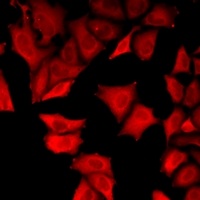 USP8 Rabbit Polyclonal Antibody