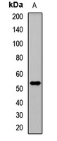 TRAF4 Rabbit Polyclonal Antibody