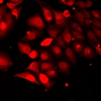 TRAF4 Rabbit Polyclonal Antibody