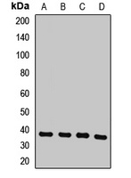 COPS6 Rabbit Polyclonal Antibody