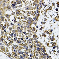 CD275 Rabbit Polyclonal Antibody