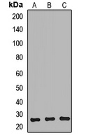 NTMT1 Rabbit Polyclonal Antibody