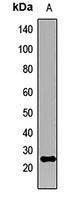 KCNIP2 Rabbit Polyclonal Antibody