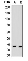 ART5 Rabbit Polyclonal Antibody