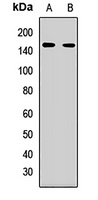 REST Rabbit Polyclonal Antibody
