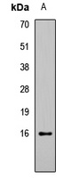Histone H3 (Acetyl-K27) Rabbit Polyclonal Antibody