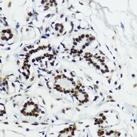 Histone H3 (Acetyl-K27) Rabbit Polyclonal Antibody
