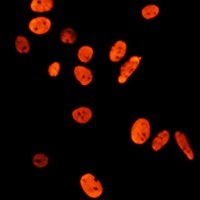 Histone H3 (Acetyl-K27) Rabbit Polyclonal Antibody