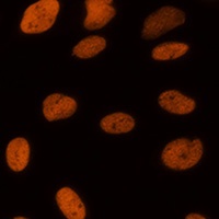 Histone H3 (Acetyl-K14) Rabbit Polyclonal Antibody
