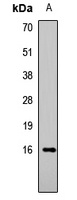 Histone H3 (Acetyl-K9) Rabbit Polyclonal Antibody