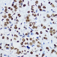 Histone H3 (Acetyl-K9) Rabbit Polyclonal Antibody