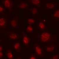 Histone H3 (Acetyl-K9) Rabbit Polyclonal Antibody