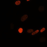 Histone H3 (Acetyl-K56) Rabbit Polyclonal Antibody
