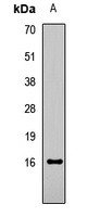 Histone H3 (Acetyl-K18) Rabbit Polyclonal Antibody
