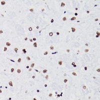 Histone H3 (Acetyl-K18) Rabbit Polyclonal Antibody