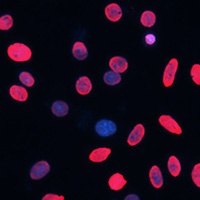 Histone H3 (Acetyl-K18) Rabbit Polyclonal Antibody