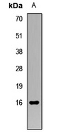 Histone H3 (TriMethyl-K56) Rabbit Polyclonal Antibody