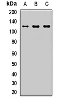 CARD10 Rabbit Polyclonal Antibody