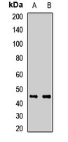 SHBG Rabbit Polyclonal Antibody