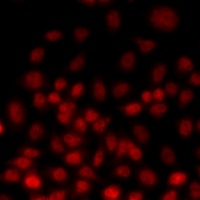 TEAD3 Rabbit Polyclonal Antibody