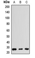 THAP1 Rabbit Polyclonal Antibody
