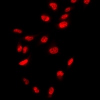 THAP1 Rabbit Polyclonal Antibody