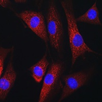 RAB1B Rabbit Polyclonal Antibody