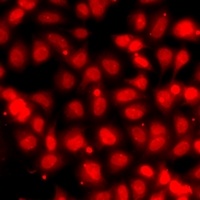 SUMO4 Rabbit Polyclonal Antibody