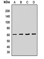 ATG14 Rabbit Polyclonal Antibody