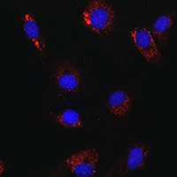 ATG14 Rabbit Polyclonal Antibody