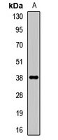 IFNGR2 Rabbit Polyclonal Antibody