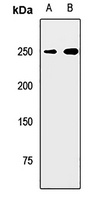 Myosin 7 Rabbit Polyclonal Antibody
