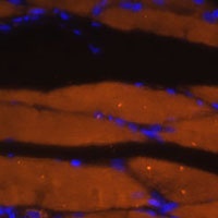 Myosin 7 Rabbit Polyclonal Antibody
