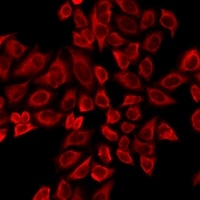 TTBK2 Rabbit Polyclonal Antibody