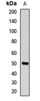 SHH Rabbit Polyclonal Antibody
