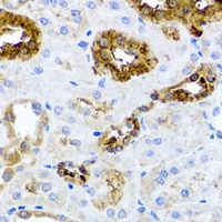 SHH Rabbit Polyclonal Antibody