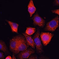 SHH Rabbit Polyclonal Antibody