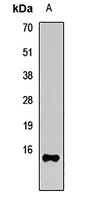 UBE2A Rabbit Polyclonal Antibody