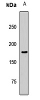 KDM5B Rabbit Polyclonal Antibody