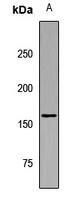 ARHGEF11 Rabbit Polyclonal Antibody