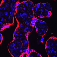 HSD3B1 Rabbit Polyclonal Antibody